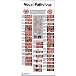 Vocal Pathology Large Poster