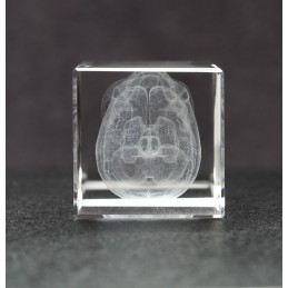Skull and Brain Crystal Art top view