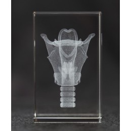 Larynx Crystal Art 1lb back view
