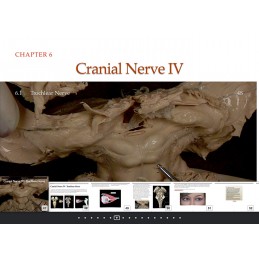 Cranial Nerves iBook Thumbnail Navigate
