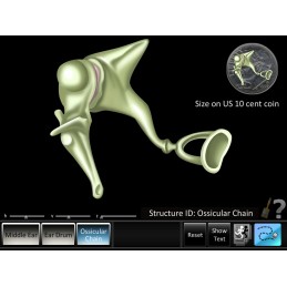 ENT Computer Software App and Chart Set - Middle Ear ID
