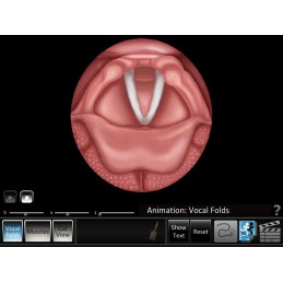 ENT Computer Software App and Chart Set - Vocal Folds ID