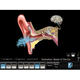 Hearing Computer Software and Chart Set - Ear Disorders - Outer, Middle