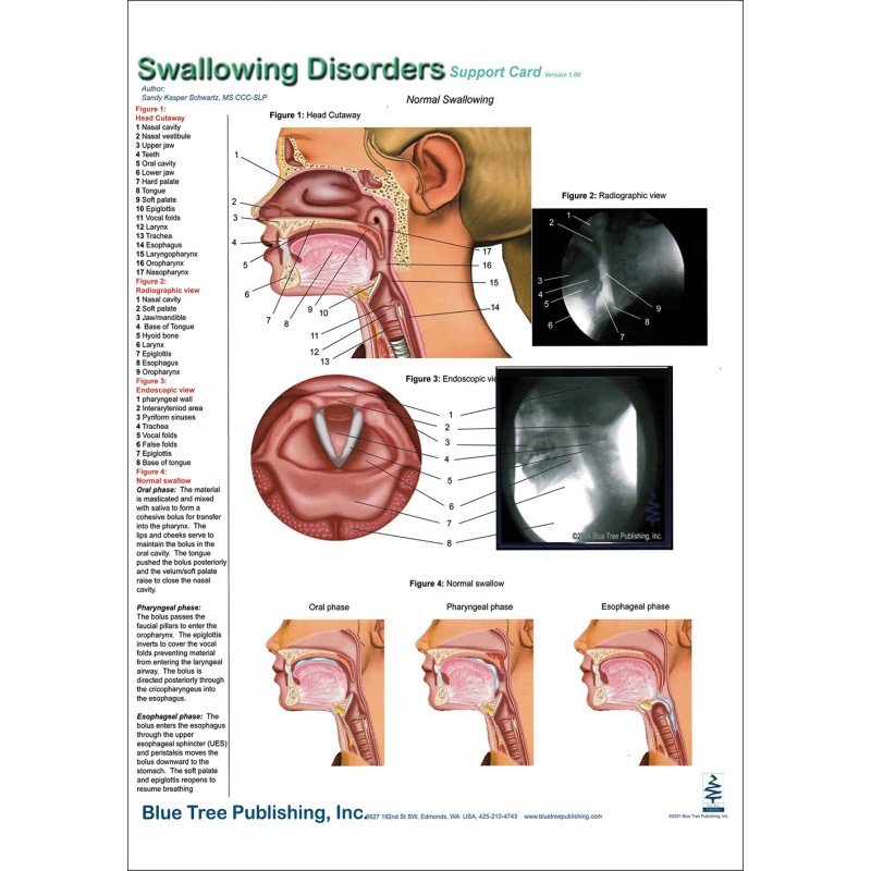 Swallowing Disorders Anatomical Chart card 01 front