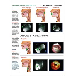Swallowing Disorders Anatomical Chart card 02 front