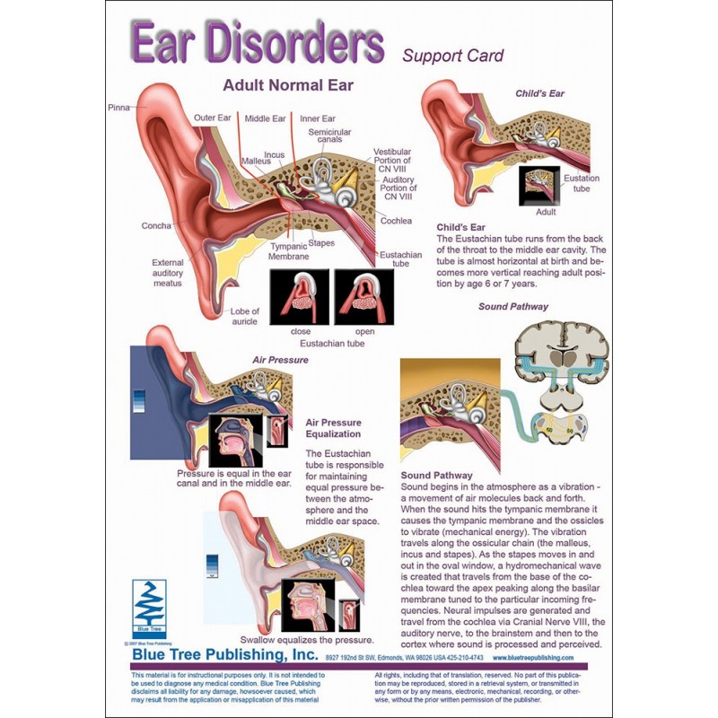 Ear Disorders Anatomical Charts card one front