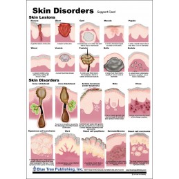 Skin and Skin Disorders Anatomical Chart back