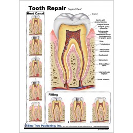 Tooth Repair Anatomical Chart front
