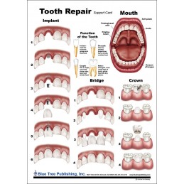 Tooth Repair Anatomical Chart back
