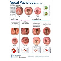 Vocal Pathology I Anatomical Chart front