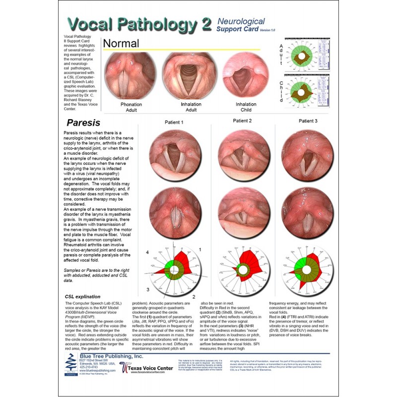 Vocal Pathology II Anatomical Chart front