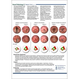 Vocal Pathology II Anatomical Chart back