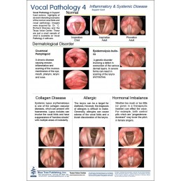 Vocal Pathology IV Anatomical Chart card 1 front