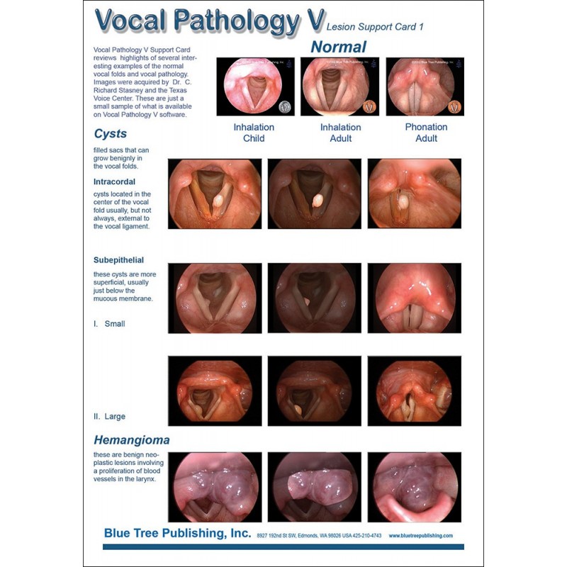 Vocal Pathology V Anatomical Chart car 1 front