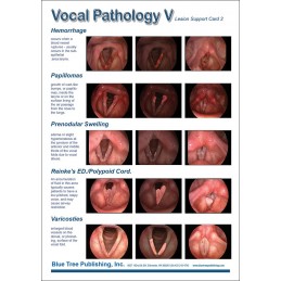 Vocal Pathology V Anatomical Chart card 1 back