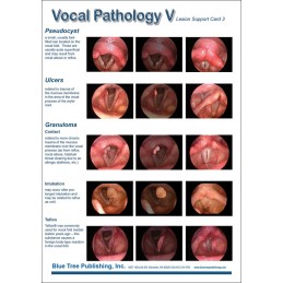 Vocal Pathology V Anatomical Chart card 2 front