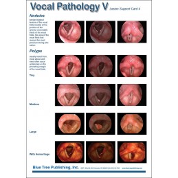 Vocal Pathology V Anatomical Chart card 2 back