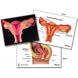 Uterus Anatomical Chart and Model