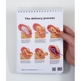 Female Anatomy Flip Chart delivery process