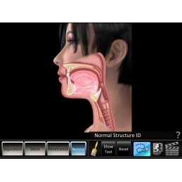 Swallowing Aspiration Disorders Mobile App key view