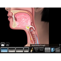 Swallowing Aspiration Disorders Mobile App zoomed in animation