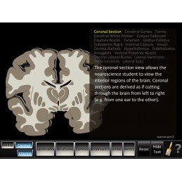 Cerebrum ID Mobile App coronal section view