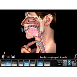 Laryngectomy Mobile App tracheoesophageal speech