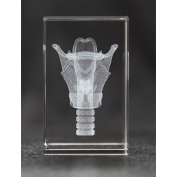 Larynx Crystal Art 1lb front view