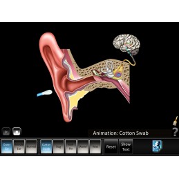 Ear Disorders - Outer Middle Ear Mobile App ear swab animation