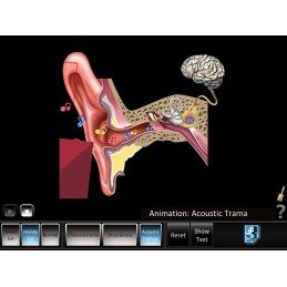 Ear Disorders - Outer Middle Ear Mobile App acoustic trauma animation