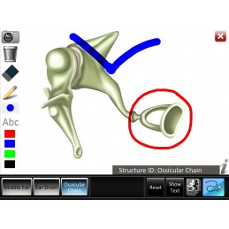 Middle Ear ID Mobile App drawing feature