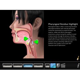 Swallowing Residue Disorders Mobile App key highlight