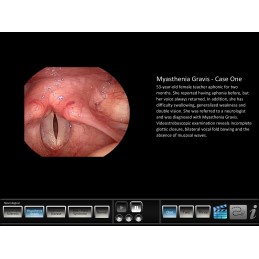 Vocal Pathology - Neurological Mobile App video view
