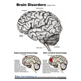 Brain and Brain Disorders Anatomical Chart disorders chart front