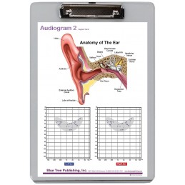 Audiogram Dry Erase Clipboard front