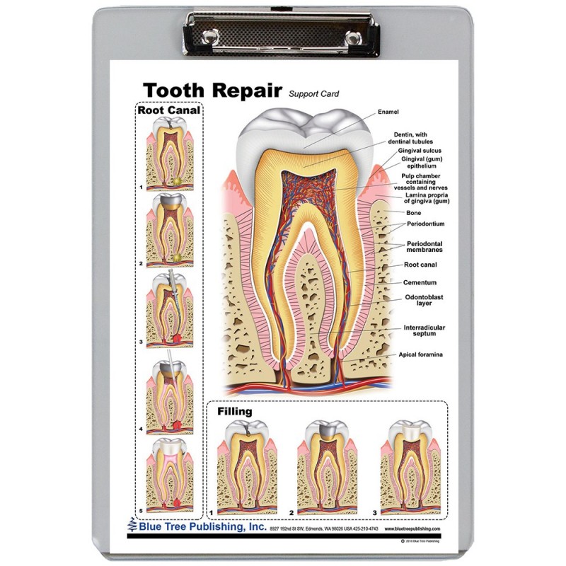 Tooth Repair Dry Erase Clipboard front