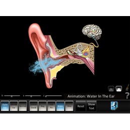 Hearing 6 App Computer Software Set - Ear Disorders Outer, Middle Ear