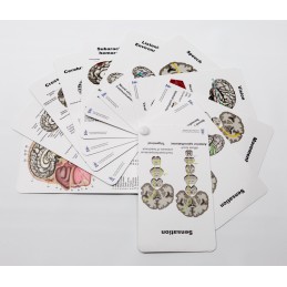 Brain Anatomy Pocket Charts back