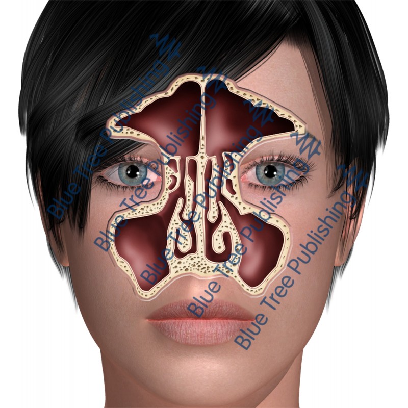 Sinus Front - Download Images