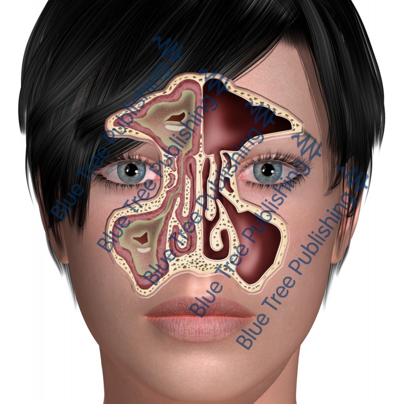 Sinus Front Abnormal - Download Images