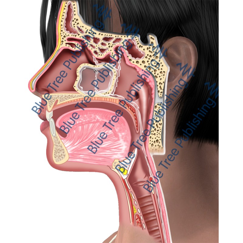 Sinus Side Normal  - Download Images