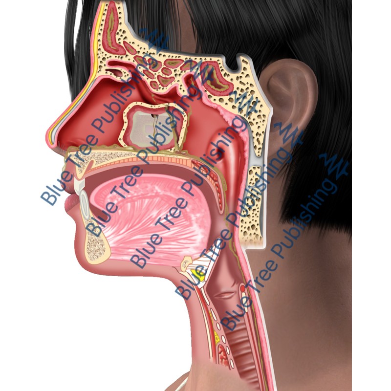 Sinus Side Abnormal  - Download Images