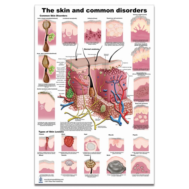 Skin and Skin Disorders Large Poster