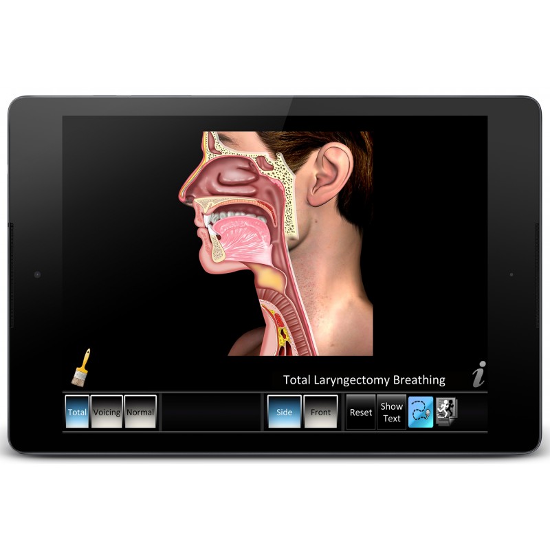 Laryngectomy Mobile App