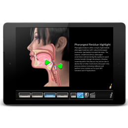 Swallowing Oral Disorders Mobile App