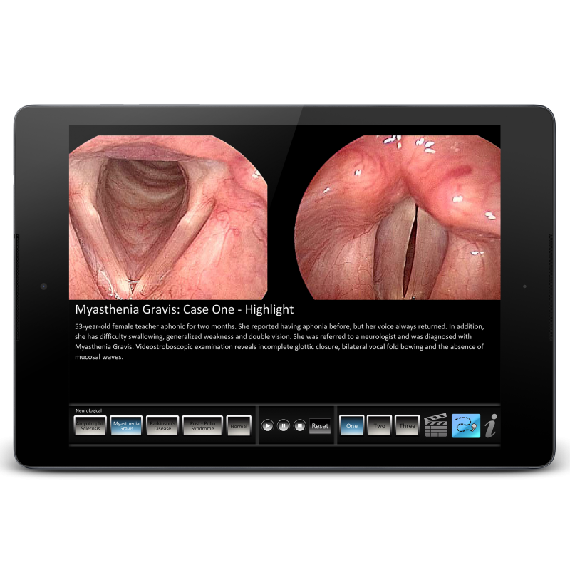 Vocal Pathology - Neurological Mobile App