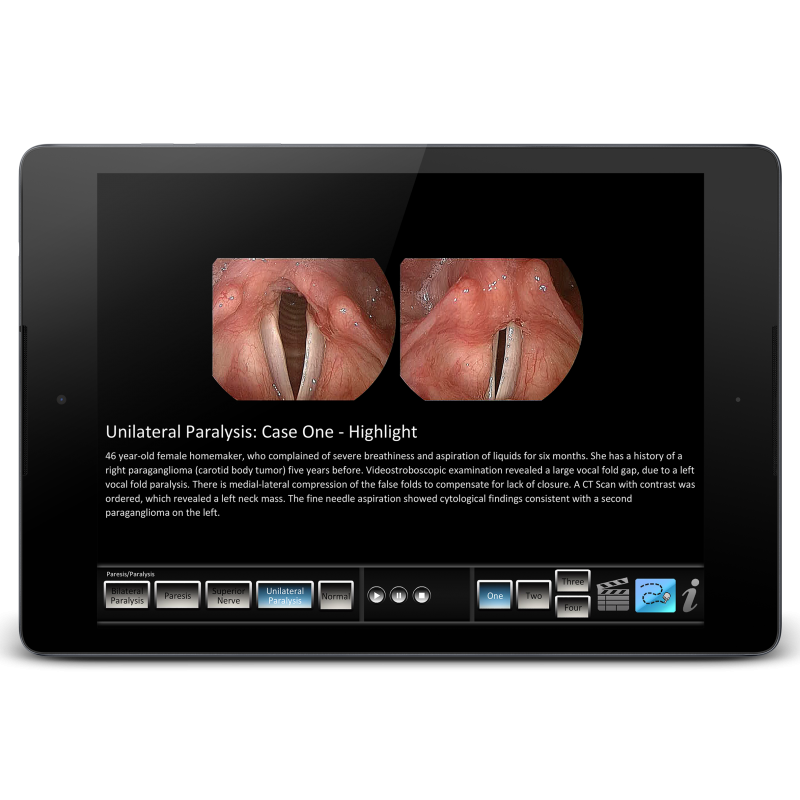 Vocal Pathology - Paresis/Paralysis Mobile App