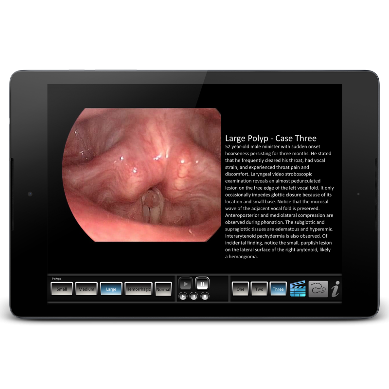 Vocal Pathology - Polyps Mobile App