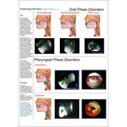 Swallowing Disorders Anatomical Chart - card two front