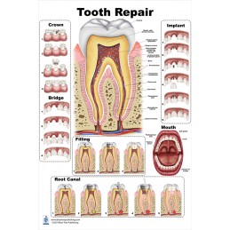 Tooth Repair Large Poster